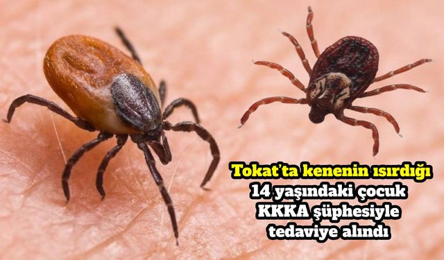 Tokat’ta Kene Isıran 14 Yaşındaki Çocuk KKKA Şüphesiyle Tedaviye Alındı